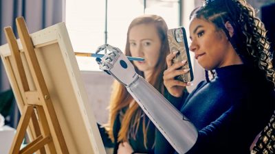 Ottobock протезування рук, протезування верхніх кінцівок