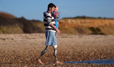 Genium X4 від Ottobock - колінний модуль наступного покоління